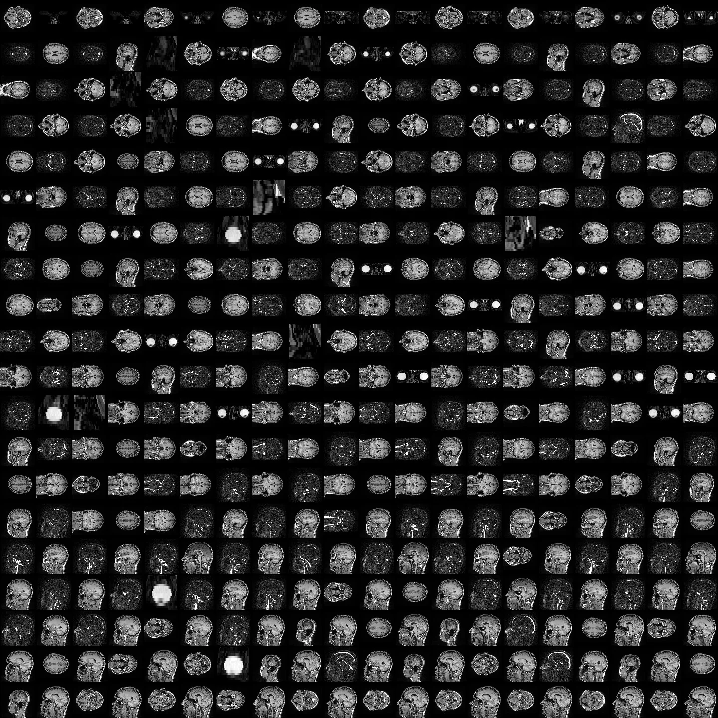 A 20 by 20 checkerboard of 400 actual MRI cross-sections, mixing T1, contrast angiography and Dixon-water eye scans.